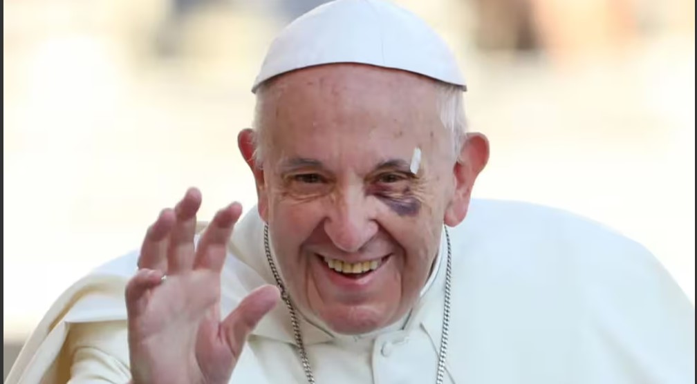 En Cartagena de Indias (2017) el papa Francisco sufrió un "puñetazo" cuando por accidente se golpeó en el ojo en medio de la muchedumbre